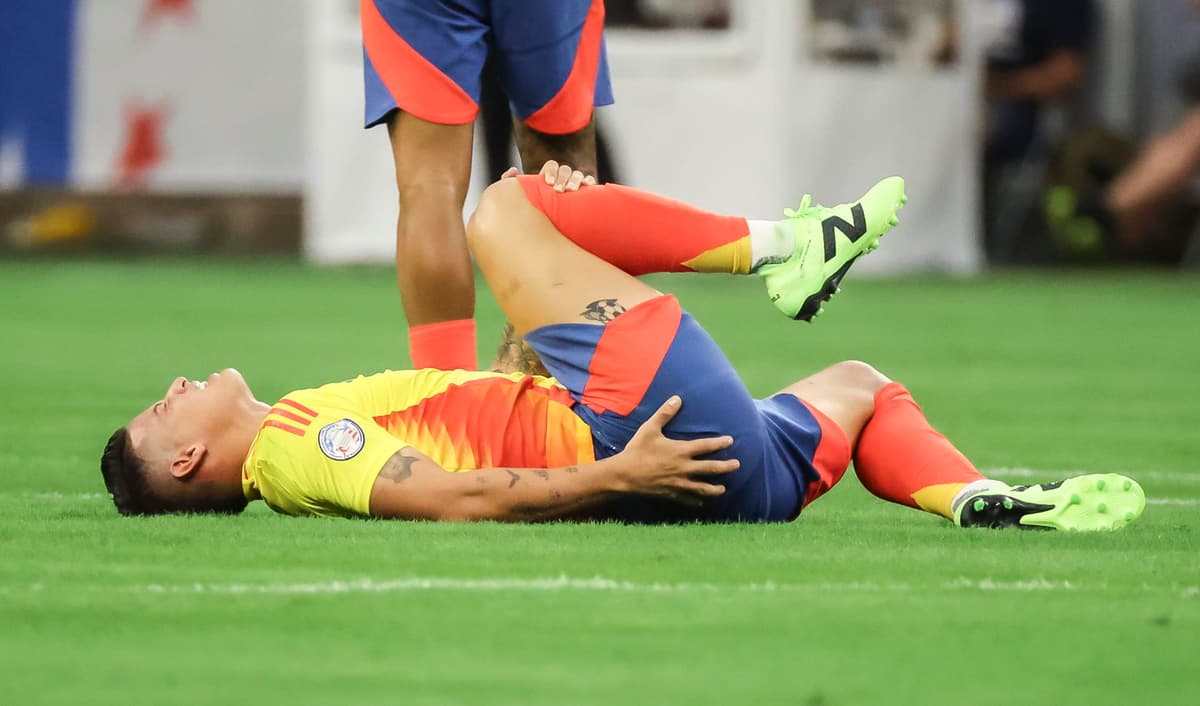 Colombiano James dice que es mejor ganar y corregir cosas