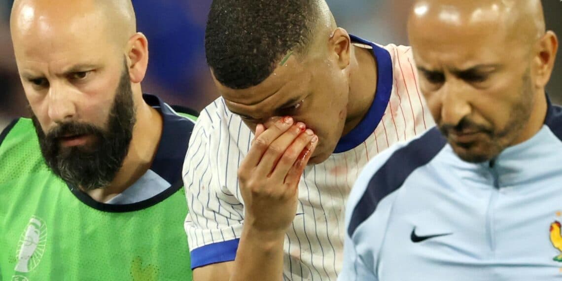 La duda de Mbappé en la primera fase, la dependencia de Francia de su figura