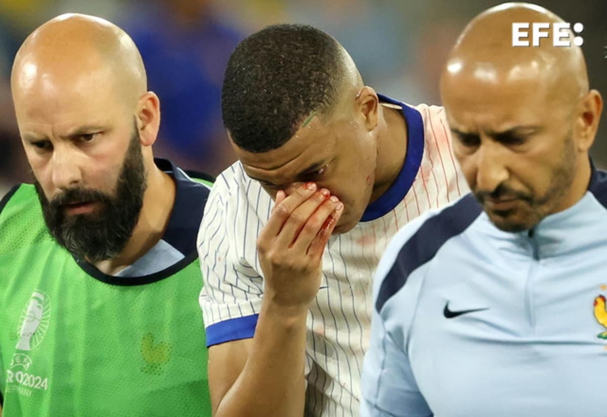 Mbappé sufre fractura de nariz
