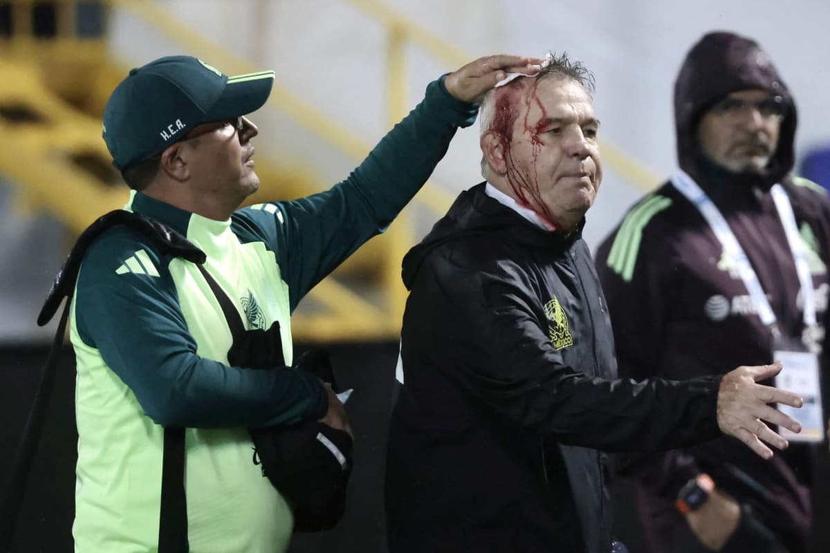 La Concacaf investigará la agresión al mexicano Aguirre